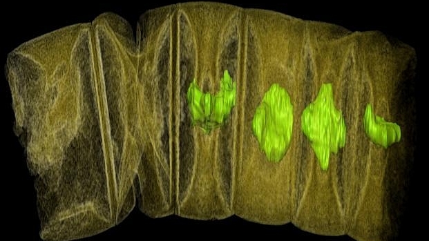 X-ray tomographic picture of fossil thread-like red algae. (Stefan Bengtson/Handout via Reuters) 