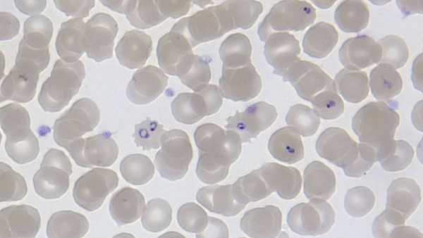  A Discovery That Can Lead Us To A New Drug To Fight Malaria