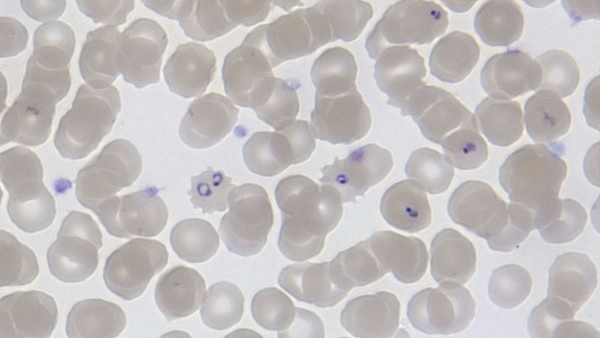 “Ring forms” of the Plasmodium falciparum (malaria) parasite, inside red blood cells. (Michael Zahniser)