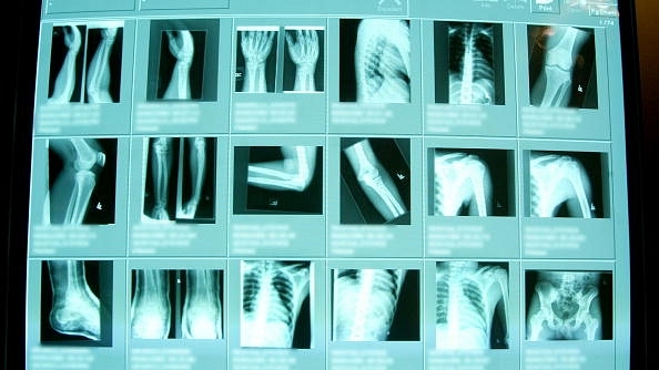 High resolution digital x-rays are seen in the emergency room at Coney Island Hospital, in  New York City. (Mario Tama/Getty Images)