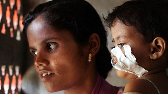 One-year-old Jotsna, who displays symptoms of malnutrition, with her mother Bharti Mayekar. (Manoj Patil/Hindustan Times via Getty Images)