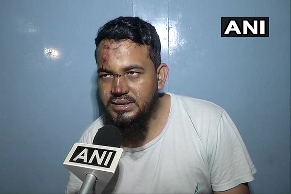 Madrasa Teacher Claims He Was Hit By Car For Not Chanting ‘Jai Shri Ram’; Charge Not Yet Proved By Eyewitness Accounts 