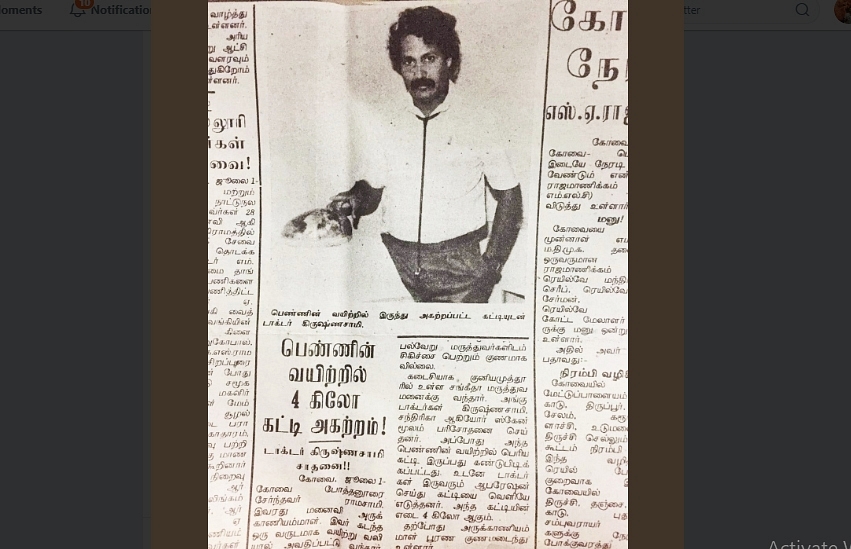 A brilliant surgeon: In 1988, Dr. Krishnasamy made it to the newspapers when he saved a woman by removing a 4-kilo tumour from her stomach.