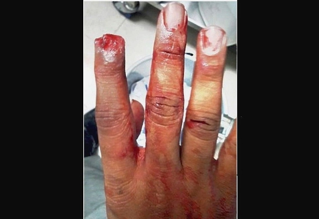 The victim’s finger