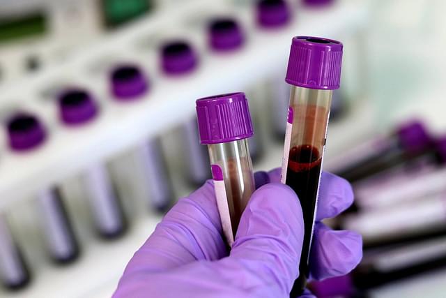 Pune Serosurvey: Does High Prevalence Say Anything About Herd Immunity?