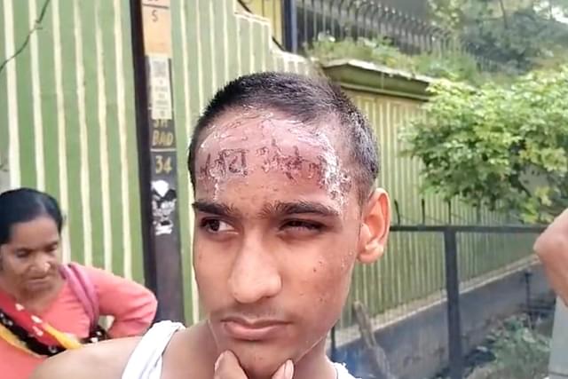 Did Hindus Carve 'Jai Bholenath' On Muslim Boy's Forehead With Knife In Bareilly? Fake Communal News Circulated On Social Media