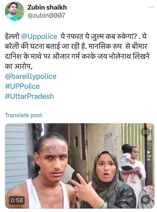 Did Hindus Carve 'Jai Bholenath' On Muslim Boy's Forehead With Knife In Bareilly? Fake Communal News Circulated On Social Media