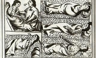 Illustration of Smallpox