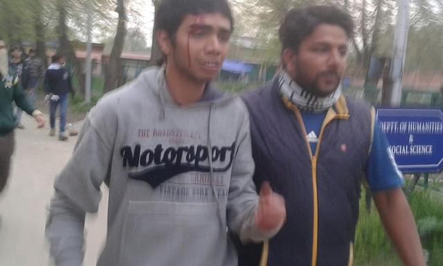 An injured student in NIT Srinagar
