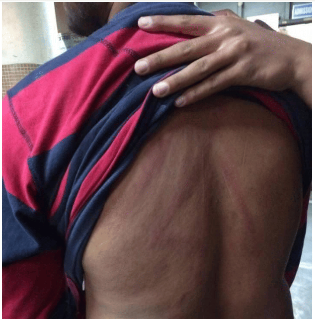 

Pictures of attacks on common students and ABVP activists by Leftists and Delhi Police. (Photos by Diksha Verma)