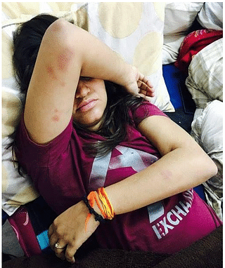 

Pictures of attacks on common students and ABVP activists by Leftists and Delhi Police. (Photos by Diksha Verma)