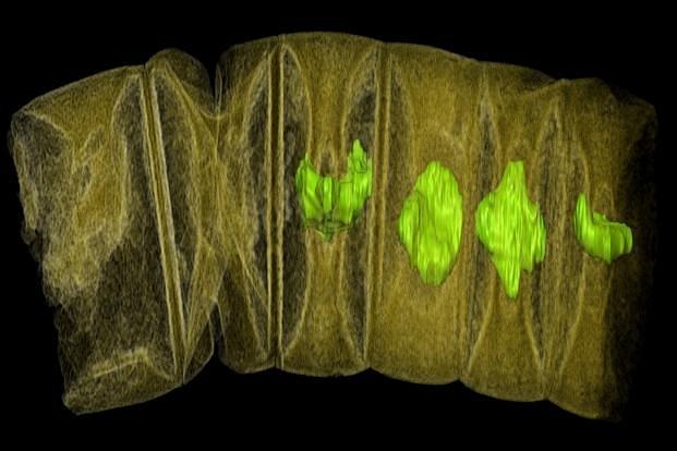 X-ray tomographic picture of fossil thread-like red algae. (Stefan Bengtson/Handout via Reuters) 