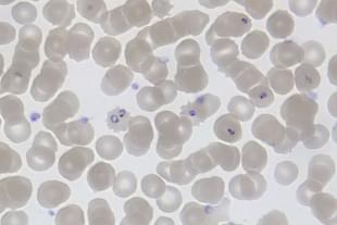 “Ring forms” of the Plasmodium falciparum (malaria) parasite, inside red blood cells. (Michael Zahniser)