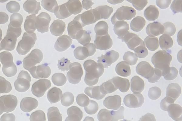 “Ring forms” of the Plasmodium falciparum (malaria) parasite, inside red blood cells. (Michael Zahniser)