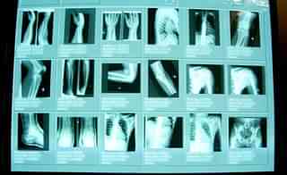 High resolution digital x-rays are seen in the emergency room at Coney Island Hospital, in  New York City. (Mario Tama/Getty Images)