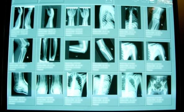 High resolution digital x-rays are seen in the emergency room at Coney Island Hospital, in New York City. (Mario Tama/Getty Images)