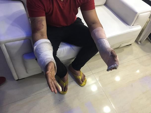 Ashish Chowdhary has sustained grievous injuries on his arm, shoulder, and neck.