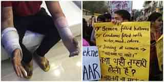 (Left) A youth was beaten to near death on Holi. (Right) Protests over unverified claims on semen-filled water balloons.