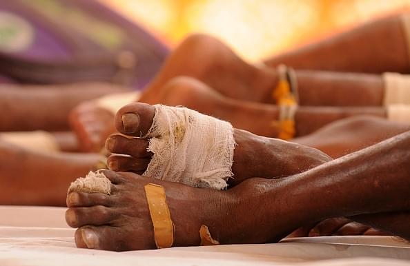 Bruised feet of Kawariyas (Getty Images)