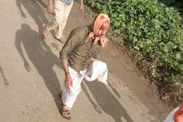 Devotee injured while protesting (@Girishvhp/Twitter)