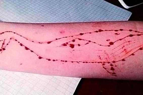 Several innocent young lives were lost in the past year due to online blue whale challenge (pic via Twitter)