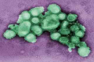 Colourised transmission electron micrograph depicting the morphology of the swine flu virus (Pic by C. S. Goldsmith and A. Balish, CDC via Wikimedia Commons)