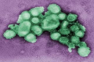 Colourised transmission electron micrograph depicting the morphology of the swine flu virus (C. S. Goldsmith and A. Balish, CDC/Wikimedia Commons)