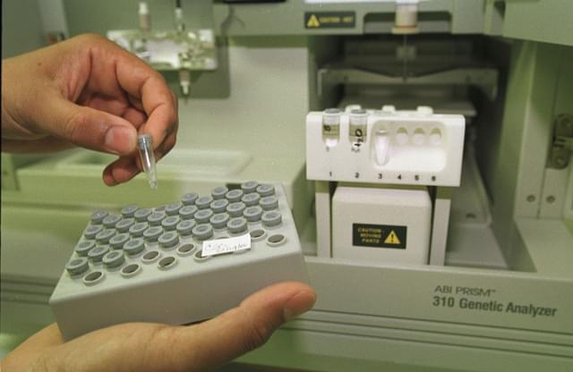A scientist working in the Broward County crime lab handles processed DNA extractions that were taken from blood samples of convicted criminals 13 July 2000 in Fort Lauderdale, FL. (Robert King/Newsmakers)&nbsp;