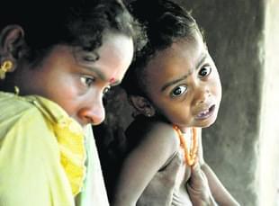 An endosulfan victim in Kasargod (Pic: Facebook)