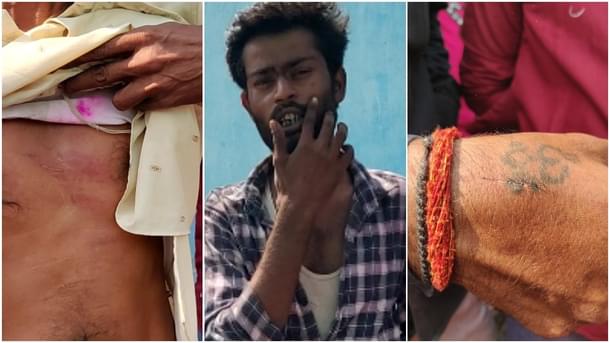 Durga visarjan participants show their wounds