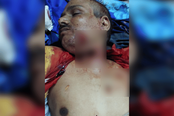 A murdered Kamlesh Tiwari. 