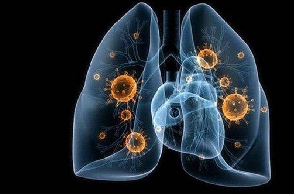 The coronavirus detected inside a pair of lungs.&nbsp;