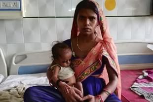 A malnourished child.