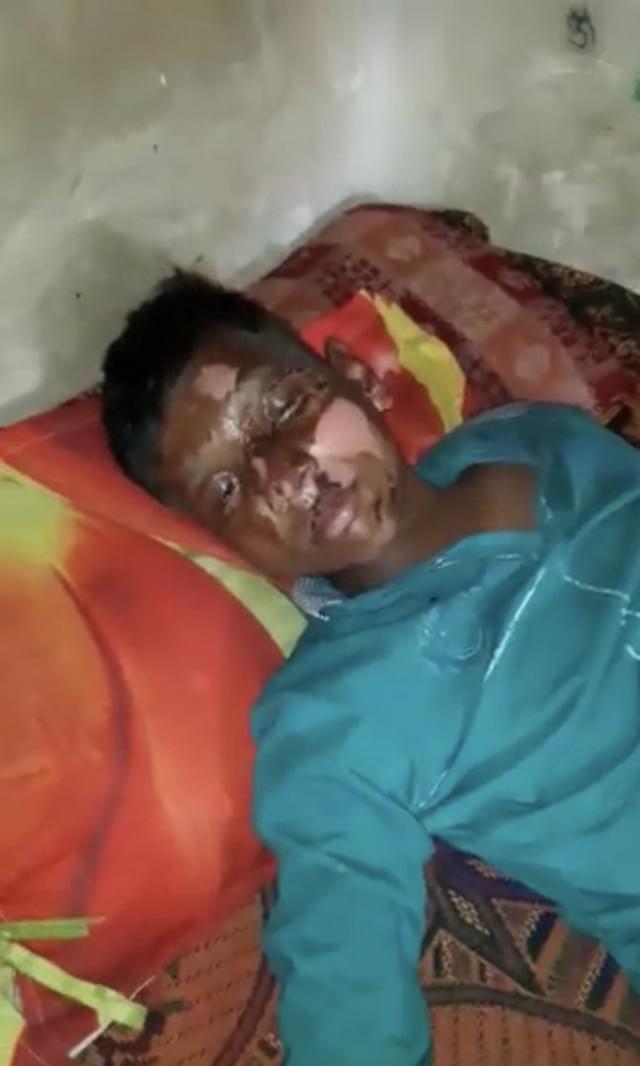 Rahul Giri, a week after the attack