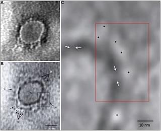 Microscopy image of SARS-CoV-2 virus (@ANI/Twitter)