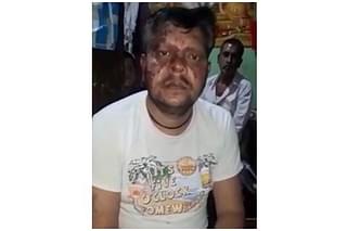 Narendra Kumar after the attack&nbsp;