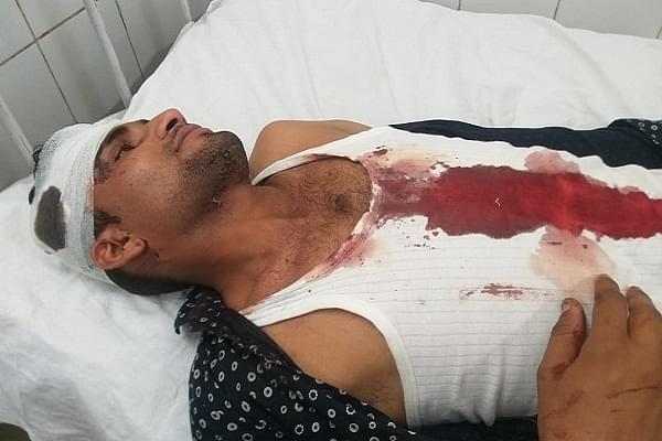 Policeman injured in attack by violent mob in Tonk (Pic via Twitter)