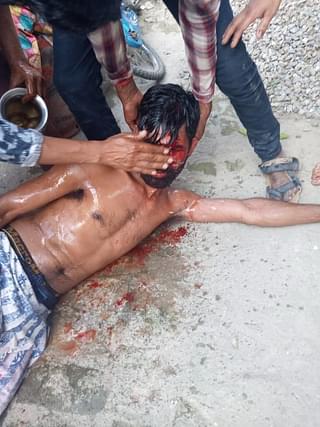 An injured Santosh Ram on 13 May/picture shared by Birendra Ram