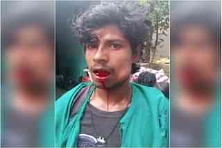 An injured Guddu Ram on 13 May/picture shared by his brother Birendra Ram