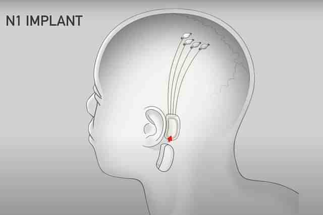 Neuralink's brain-computer interface tech (Screengrab via Neuralink's video)