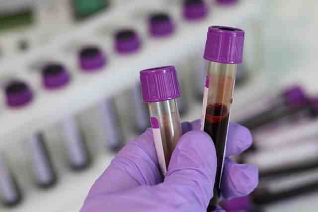 serosurvey (representative image) (Pic Via Twitter)