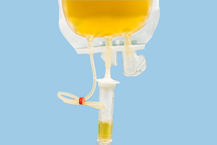 When separated from the blood, plasma is a yellow liquid (Graphics: Swarajya Magazine)