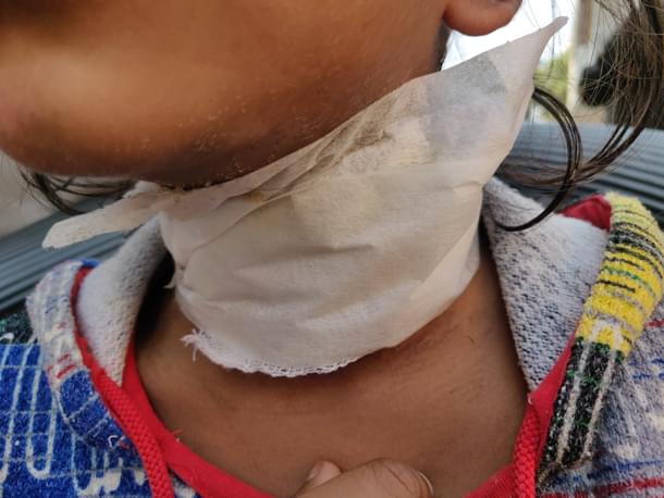 The wounds around Durga’s neck