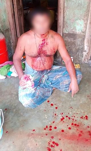 Injured BJP worker in Balurghat