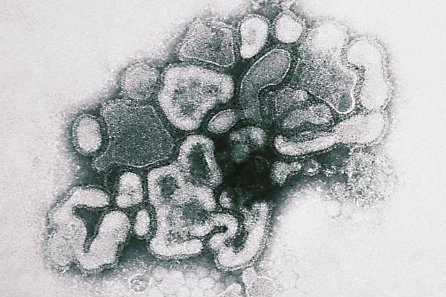 Transmission Electron Micrograph (TEM) of Spanish flu virus