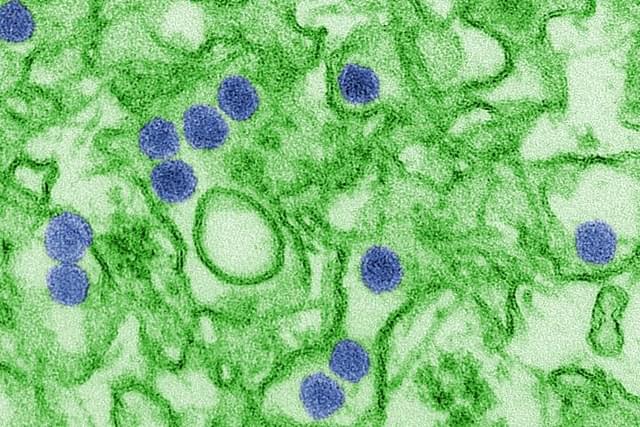 Zika Virus particle (blue colored) (Pic Via Wikipedia)
