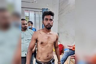 A picture of Durgesh after the assault. 