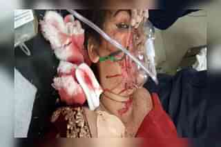 The victim, Tanishka Sharma, in hospital.