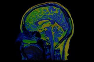 Representative image of a human brain's fMRI scan 