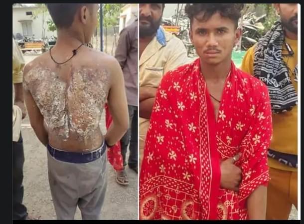 Sawan Gangle, he was admitted to the government hospital when this correspondent visited his home